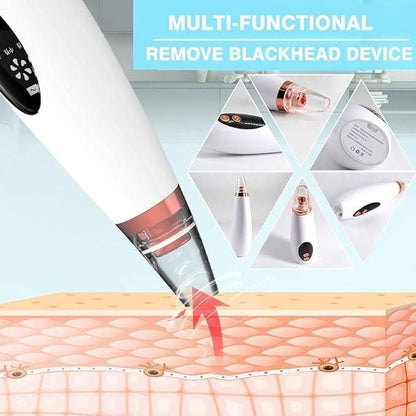 ALLTROVES 6 in 1 Multi-function Blackhead Remover Tools